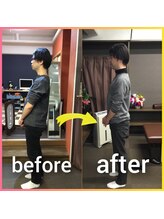 ファースト接骨院 八事日赤駅南院/before　＆　after