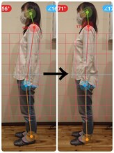 ふくろう整骨院/ビフォーアフター