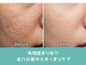 【毛穴カメラ診断付き毛穴洗浄】思わず触りたくなるうるつや卵肌に♪¥7,800