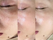 ウィル 二子新地(will)の雰囲気（【フェイシャルエステ】私に合うスキンケアが見つかる）