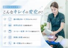 ホワイトニングショップ 旭川店