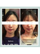 美人ヶ丘/小顔矯正,マッサージ,ヘッドスパ