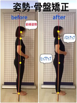 越谷KAJI整体院/美姿勢をゲット