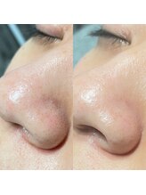 オパール 大阪梅田(op_l)/梅田/眉毛/アイブロウ/眉サロン