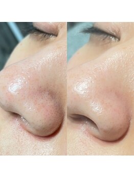 オパール 大阪梅田(op_l)/梅田/眉毛/アイブロウ/眉サロン