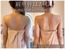 ラ ドゥーサ(La Dusa)の雰囲気（【ブライダル特化コール】肩こり/こり太り改善ドレスリンパ☆）