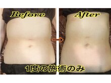 コース契約をする心配なし//完全都度払い制で不快な勧誘もなし