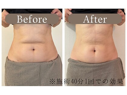 ルミーナ(Lumina)の写真