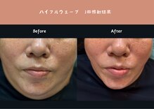アクアビューティー 金沢(Aqua Beauty)