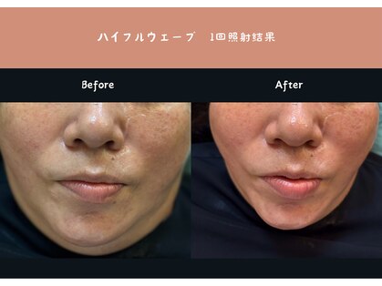 アクアビューティー 金沢(Aqua Beauty)の写真