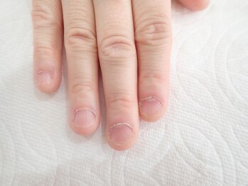 フェリーチェ(nail salon＆school felice)の写真/深爪、巻き爪、傷んだ爪、割れやすい爪等のトラブルに対応できるネイル専門店!プロのケアで健康的な美爪に!