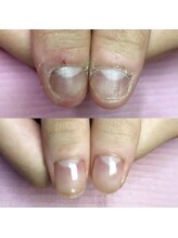 イリスネイル(IRIS NAIL)/