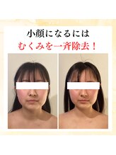 コガオテテ(Kogao tete)/むくみはなかったコトに！