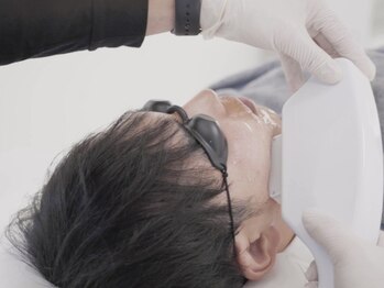 ナウザ 高崎店(NAUZA)の写真/県内最安値級のヒゲ脱毛！肌への負担も少ない脱毛で、気になるヒゲの濃さを徹底ケア◎お肌もワントーンUP！