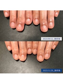 ブラン(blanc)/10.自爪育成