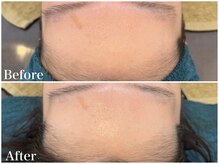 サロンドフェイス(Salon de Faith)/【フォト+ハーブ】1回施術♪