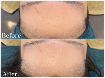 サロンドフェイス(Salon de Faith)/【フォト+ハーブ】1回施術♪