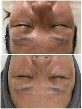 リアム(Liam)/50代からでもお肌は変わります！