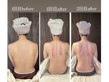 リュクス(Luxe)/初回ビフォーアフターと２回目