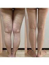 パピヨン(Papillon)/下半身ダイエット◎