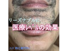 エピシアドットエヌ(epicia.N)