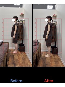 ラムーン(La.Moon)/骨盤矯正・姿勢改善