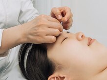 大田鍼灸【肩こり・首こり・腰痛改善/ヘッドスパ/美容鍼灸】