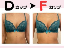 リリ(RILI)/【バストアップ・バストケア】