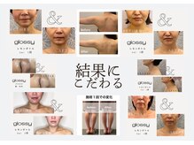 グロッシー(glossy)の雰囲気（結果にこだわるメニューで変化を楽しんでいただきたいです）