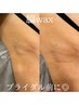 【イベント前に◎】チクチク感0！その場で綺麗に♪脇wax（保湿化粧水込み）
