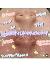 ヴォアール(VOIR)