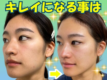 ナチュラルパーフェクトフェイス 新宿の写真