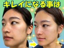 ナチュラルパーフェクトフェイス 新宿