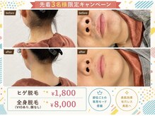 ワイズサロン(Y's salon)