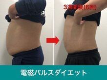 ミスターアンクール 鹿児島(Mr.uncoeur)/自動筋トレ6回後