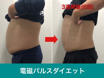 ミスターアンクール 鹿児島(Mr.uncoeur)/自動筋トレ6回後