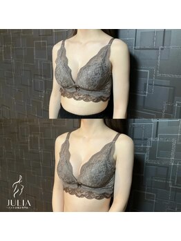 ジュリア(JULIA)/【バストアップ/育乳　症例】