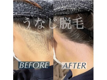 ワックスサロン ジー(waxsalon Gee!)/【うなじ×脱毛】