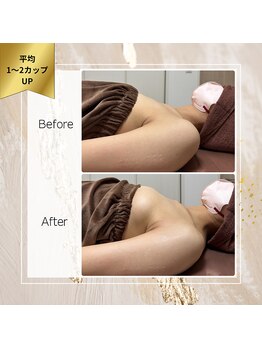 ロココ 町田店(Rococo)/コラーゲン生成でハリ感を♪