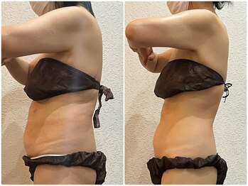 美容整体 ウェリナ 蟹江院/小顔矯正/骨盤矯正/美脚サロン 