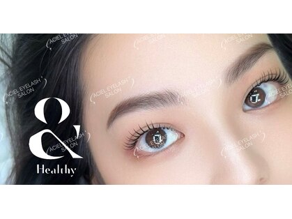 エイシェルの写真