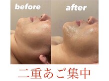 ウィズルーチェ 神栖店(with luce)