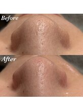 コリー(Kolly)/まさか産毛？