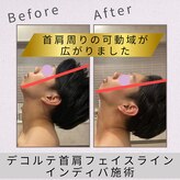 インディバ サロン ド ルル(INDIBA salon de Loulou)
