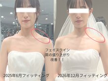 シャングリラ(Shangri-La)/挙式に向けて小顔特化メニュー！