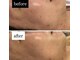 スールボーテ(soeur beaute)の写真/男性施術者が担当★韓国ララピールで自信あふれる艶肌を叶えるメンズのためのフェイシャル◎