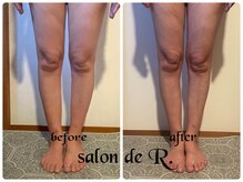 サロン ド アール(salon de R.)/【脚足骨氣・40代・施術効果】