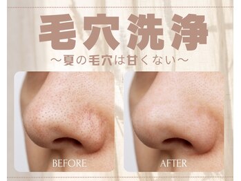 アルゴ 熊本光の森店(ALGO)/【毛穴】毛穴ごっそり大洗浄！
