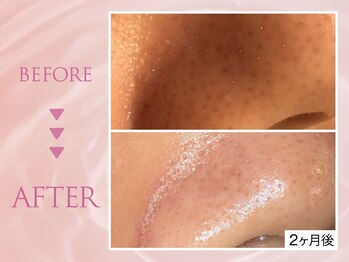 クリアラボ 川崎(Clear Lab)/韓国式肌管理&毛穴洗浄専門店