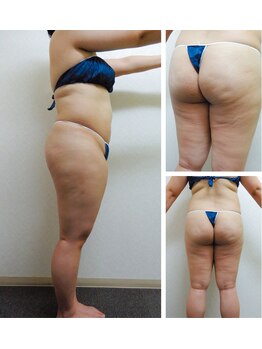 ガネェーシャ(Ganesha)/【大人気】エンダモロジー